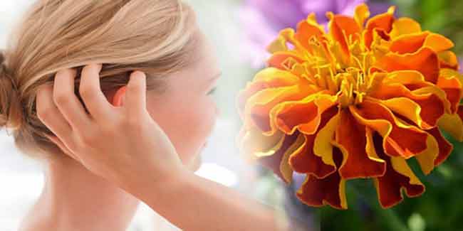 Itchy scalp? Fix it with marigold flowers